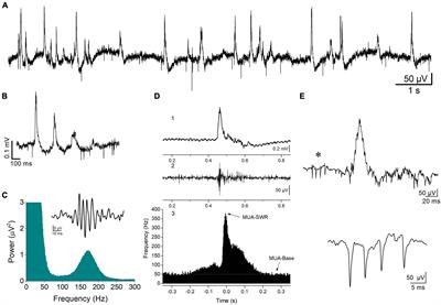 Rescue of sharp wave-ripples and prevention of network hyperexcitability in the ventral but not the dorsal hippocampus of a rat model of fragile X syndrome